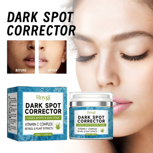 Hoygi Dark Spot Corrector cream with Vitamin C complex in blue box and jar for face on Tampa Home & Garden Store