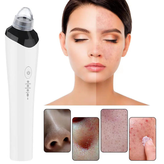 HD Visual Blackhead Meter three-speed vacuum skin care extractor white device on Tampa Home & Garden Store