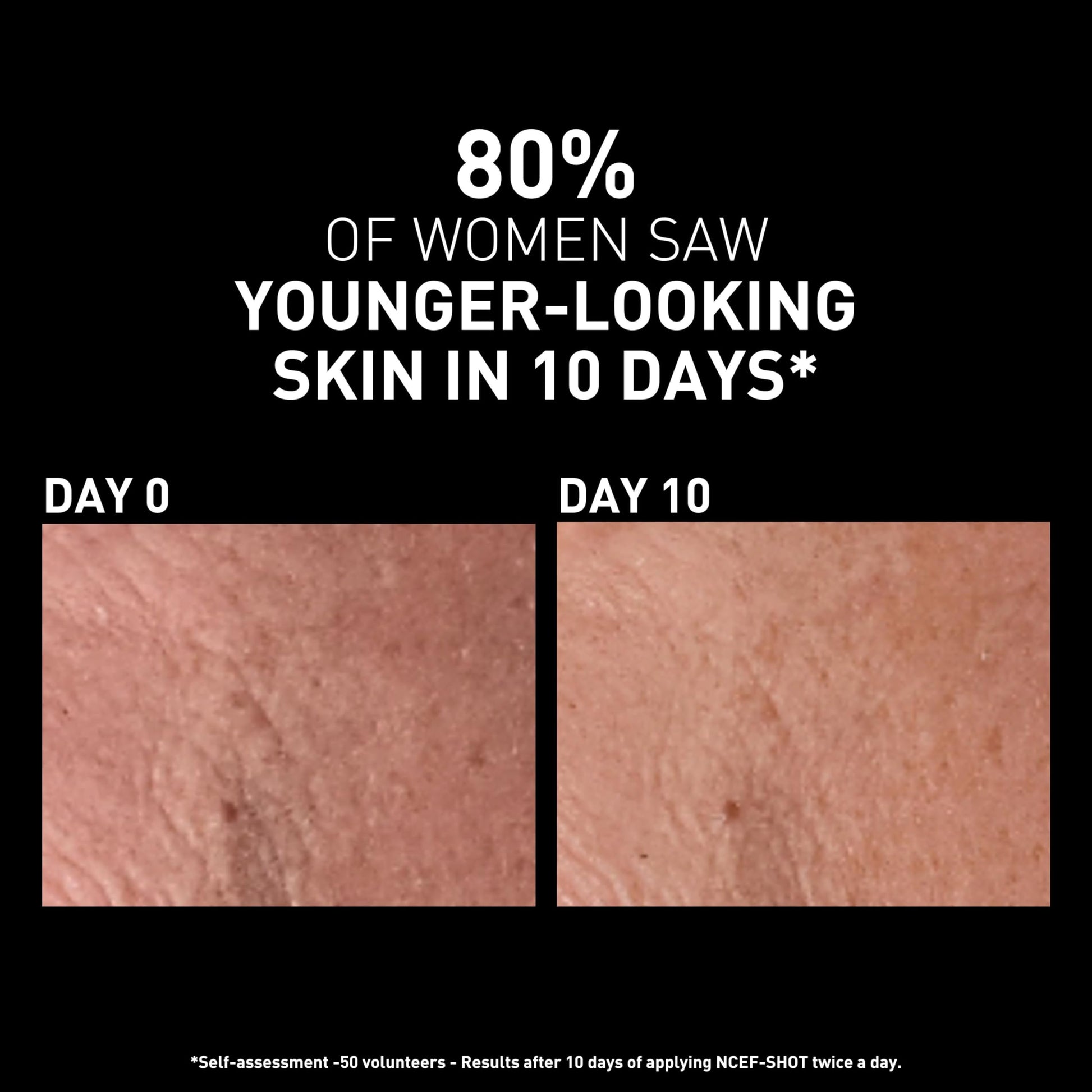 Filorga NCEF-Shot face serum Revitalizing concentrate by Beauty Care Bag day 0 to 10 skin on Tampa Home & Garden Store