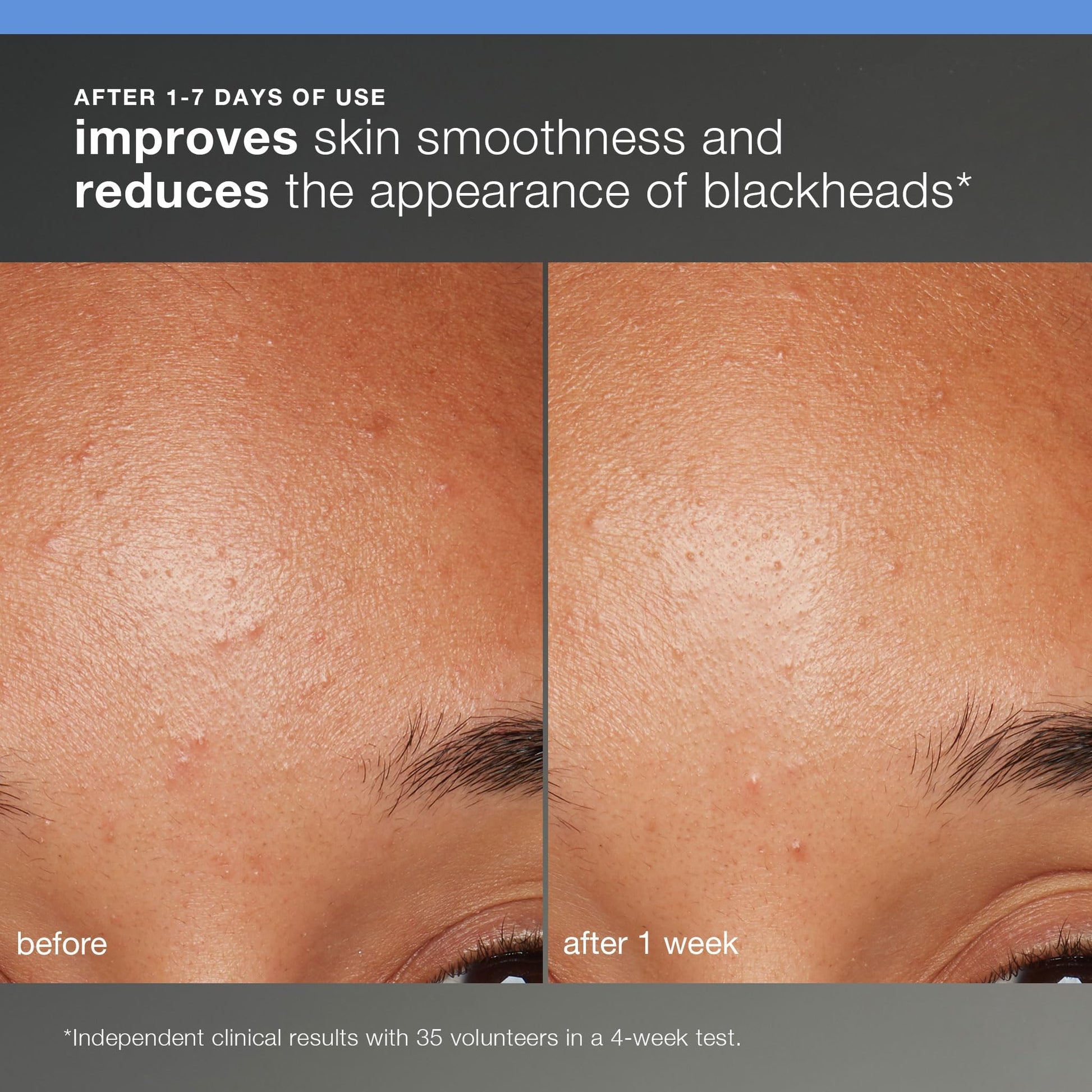 Dermalogica skincare set travel-sized exfoliator kit; before/after skin texture collage on Tampa Home & Garden Store