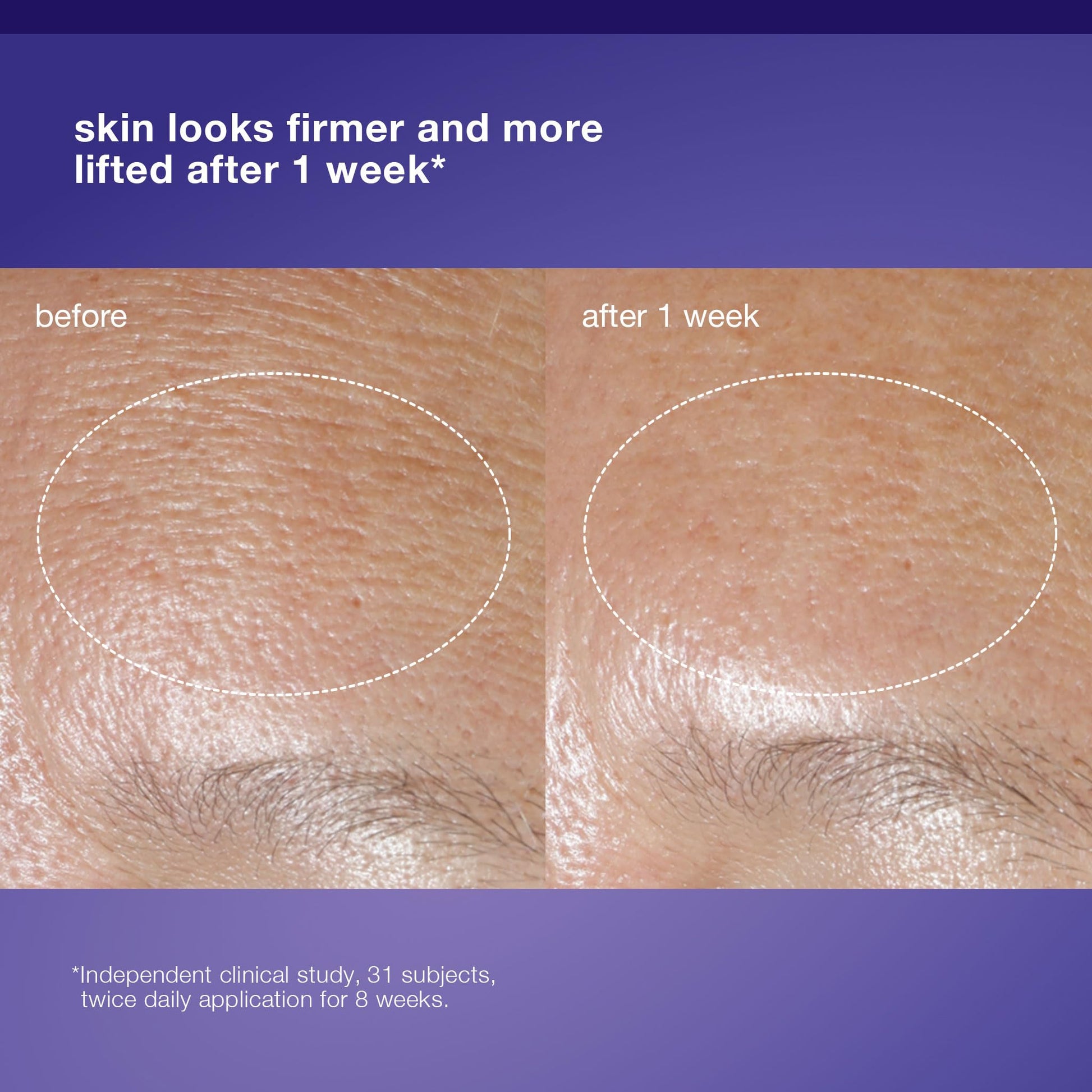 Dermalogica Phyto Nature Oxygen Cream face moisturizer; before after 1wk skin firming on Tampa Home & Garden Store