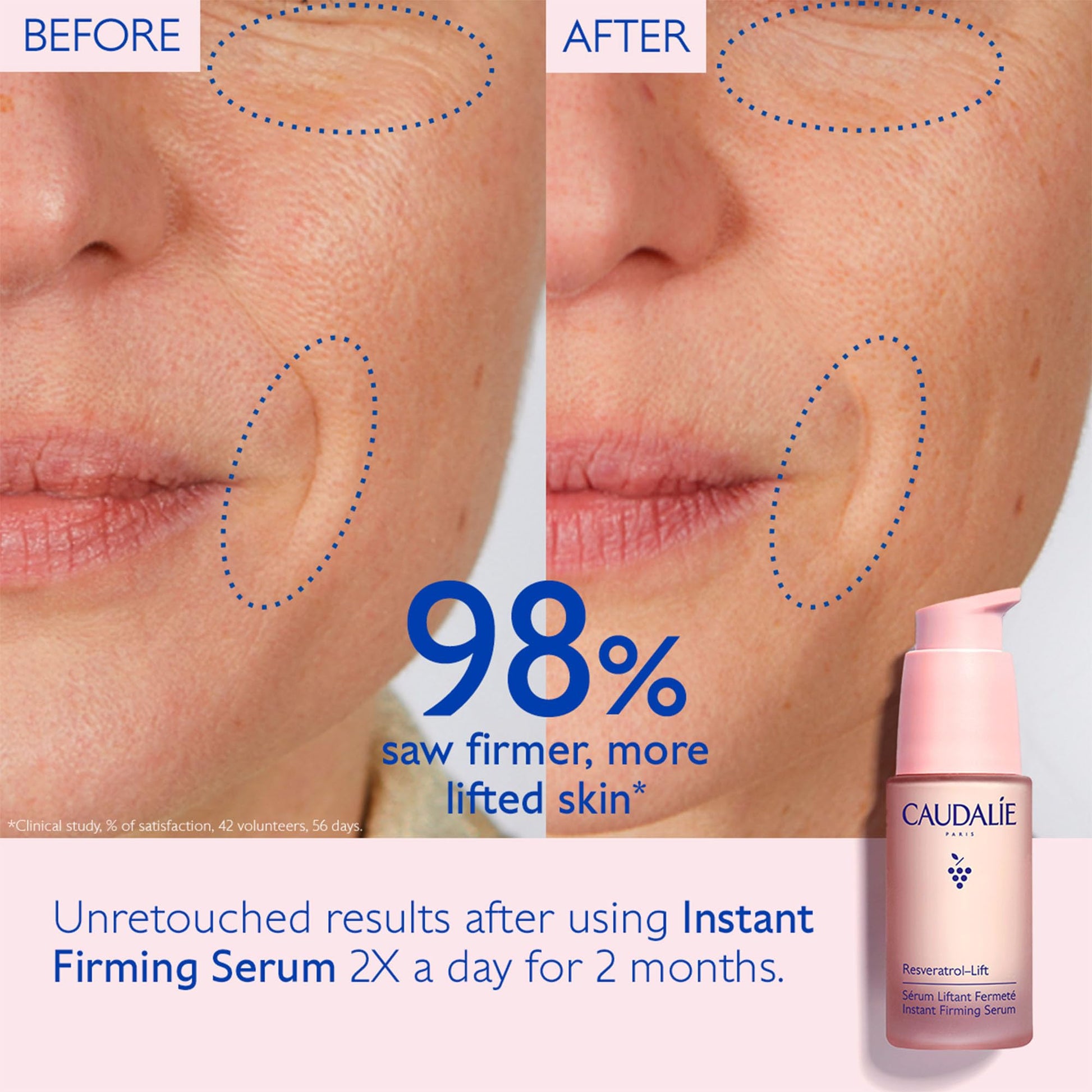 Caudalie Resveratrol Lift Firming Serum beside before-after skin shows firmer smoother skin on Tampa Home & Garden Store