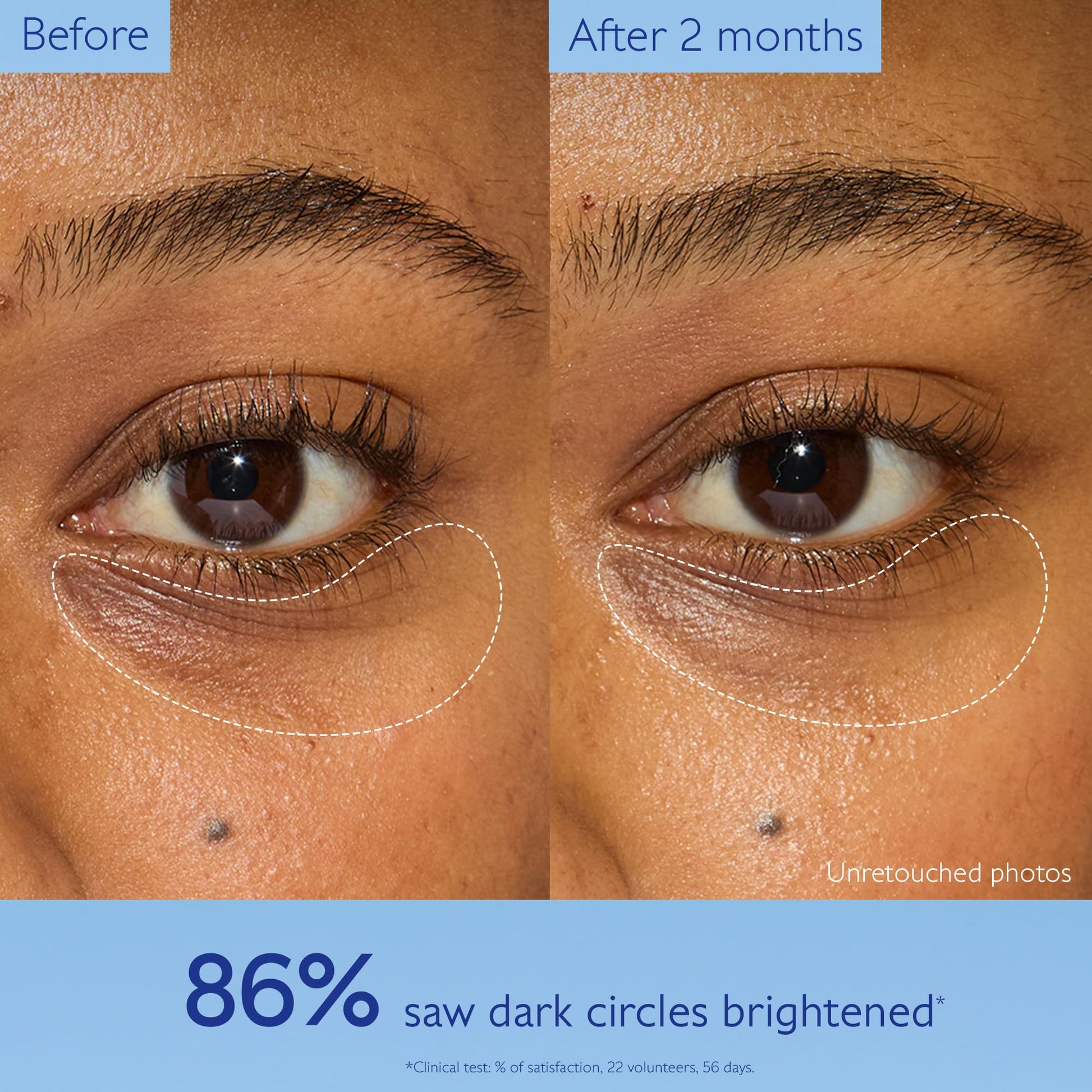 Caudalie Vinoperfect Brightening Eye Cream under-eye area before/after brightening on Tampa Home & Garden Store