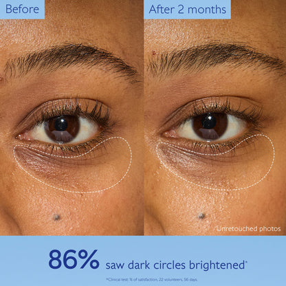 Caudalie Vinoperfect Brightening Eye Cream under-eye area before/after brightening on Tampa Home & Garden Store