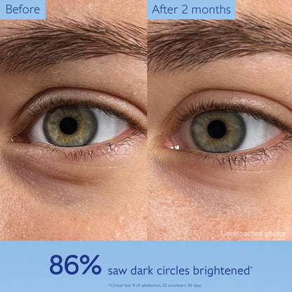Caudalie Vinoperfect Brightening Eye Cream before/after close-up of eyes; Beauty Care Bag on Tampa Home & Garden Store