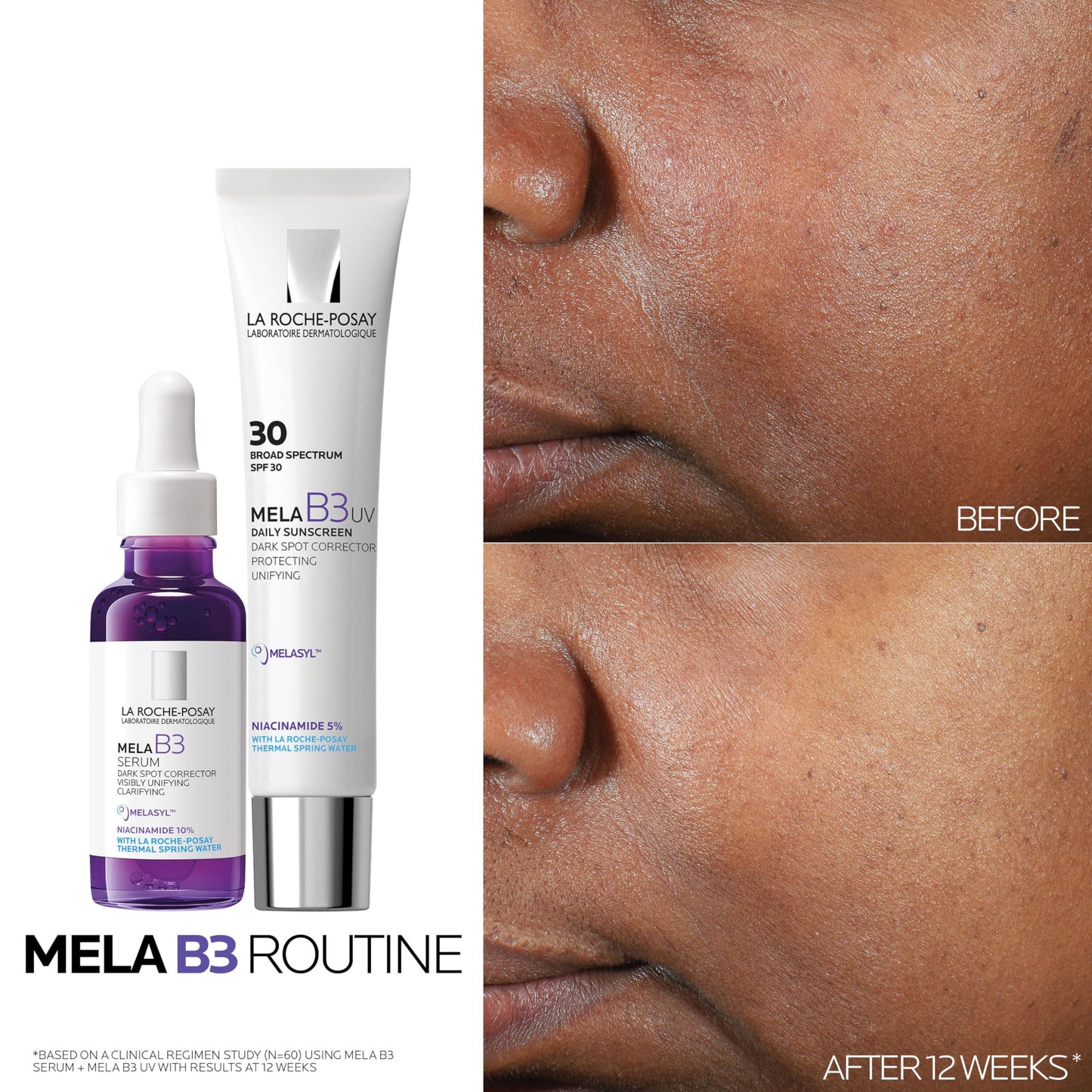 Mela B3 serum set by La Roche-Posay with Niacinamide 5% SPF 30 before/after skin closeup on Tampa Home & Garden Store
