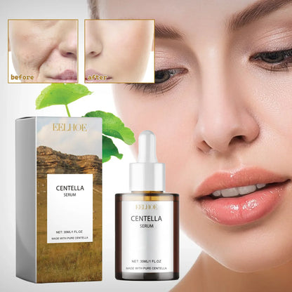 Centella Asiatica Serum by Silcy Skin - amber dropper bottle and box for deep moisture on Tampa Home & Garden Store