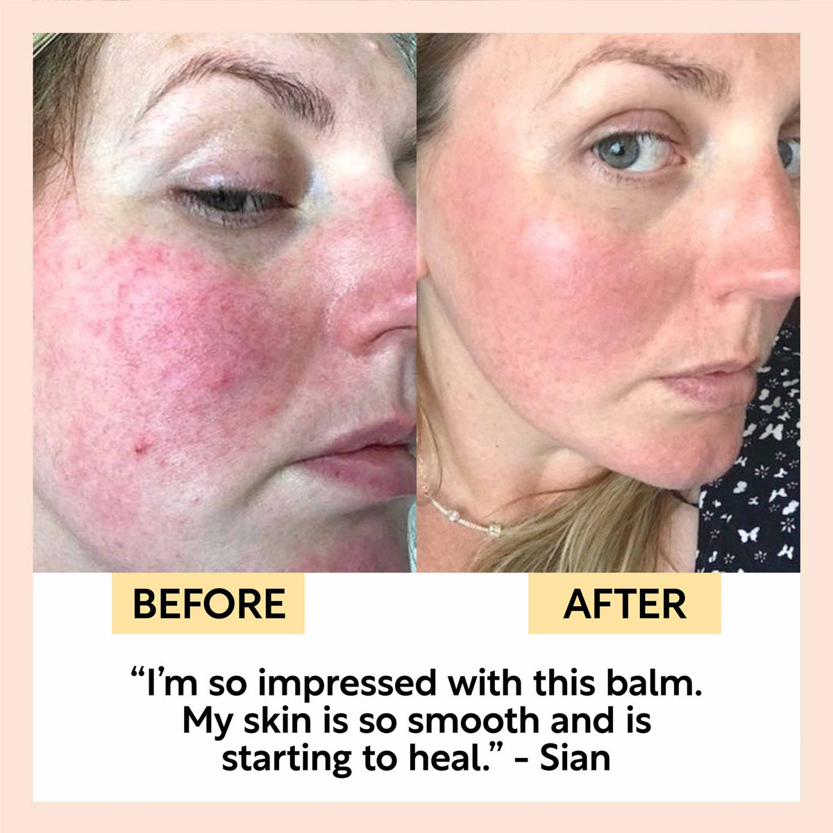 Best-Sellers Bundle UpCircle skincare before and after collage shows clearer skin on Tampa Home & Garden Store