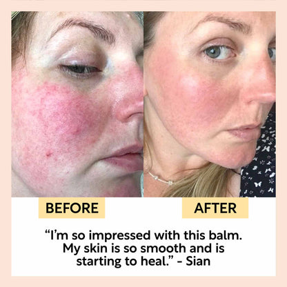 Best-Sellers Bundle UpCircle skincare before and after collage shows clearer skin on Tampa Home & Garden Store
