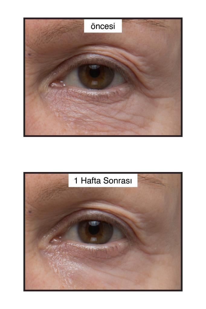 Murad Renewing Eye Cream two-panel before and after eye-area closeups on Tampa Home & Garden Store