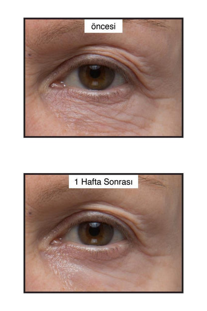 Murad Renewing Eye Cream two-panel before and after eye-area closeups on Tampa Home & Garden Store