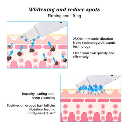 HailiCare Ultrasonic Peeling Machine To Remove Aging Horny Peeling Instrument Hydrogen And Oxygen Small Bubble Beauty - Tampa Home & Garden Store