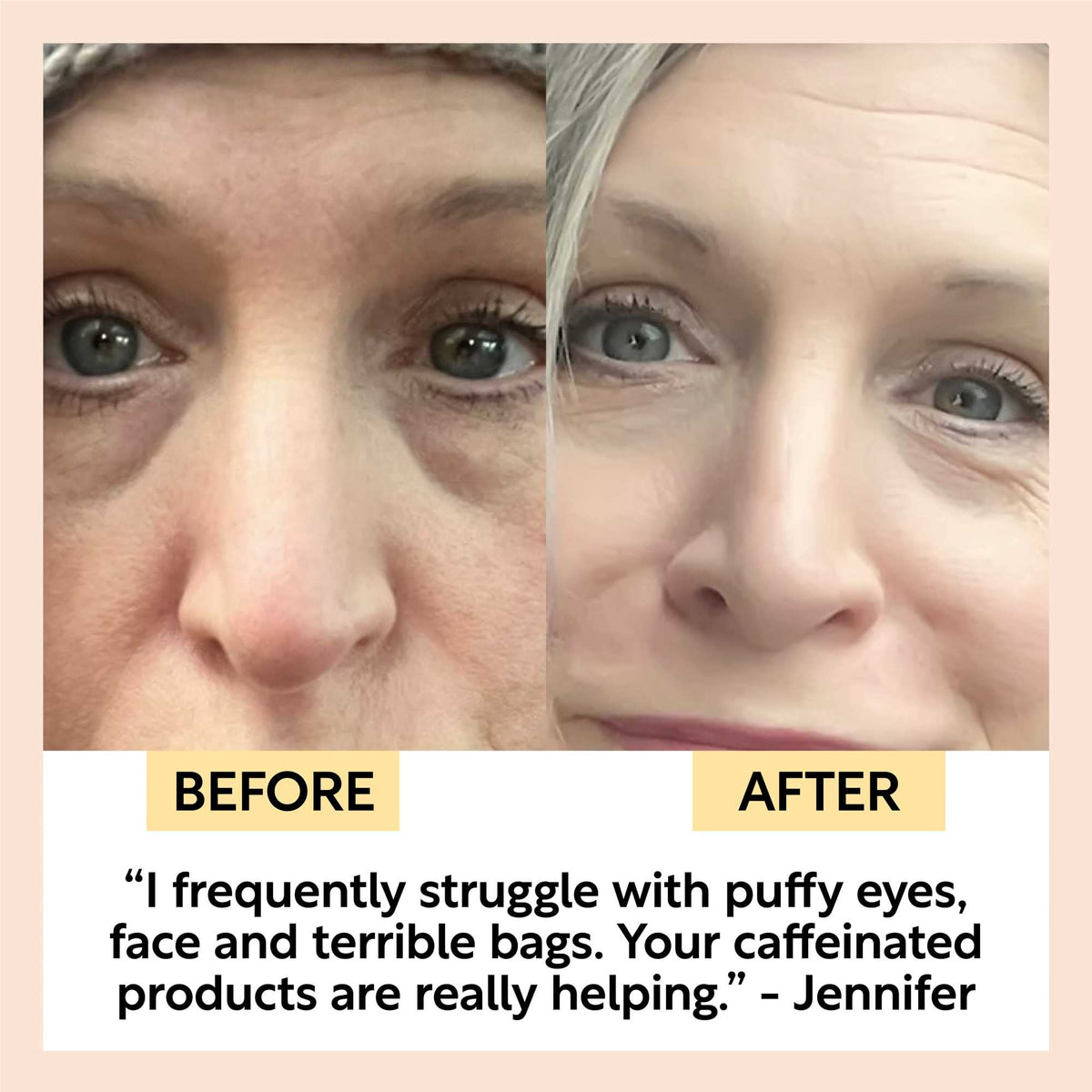 UpCircle Day + Night Eye Care Bundle skincare set, before/after collage focusing on eye area on Tampa Home & Garden Store