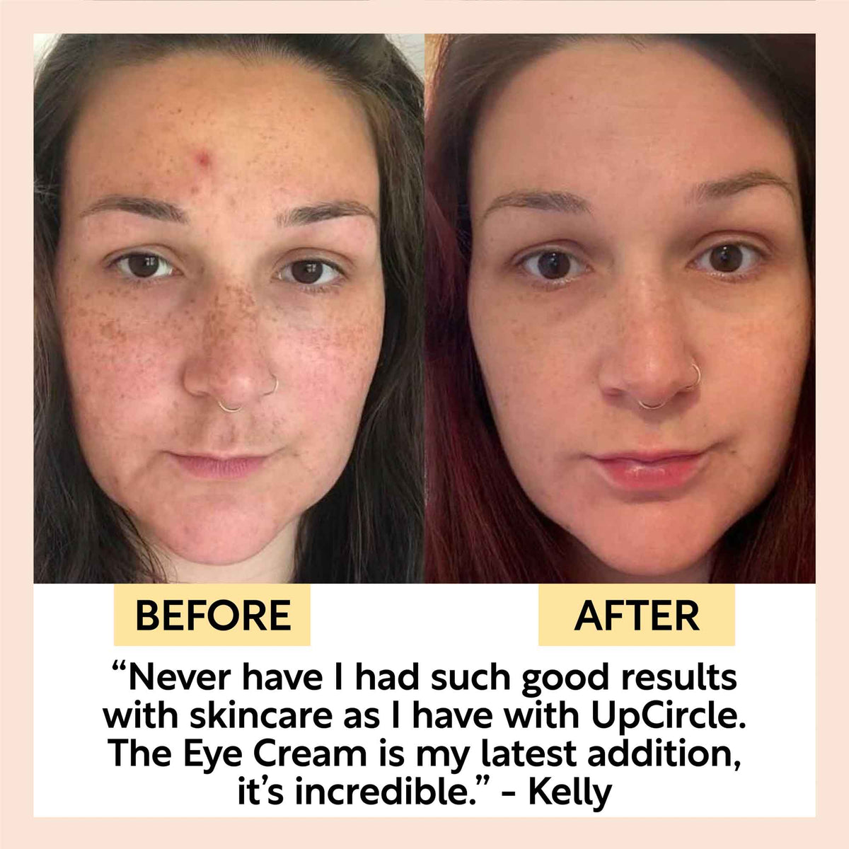 UpCircle Eye Cream with Hyaluronic Acid & Coffee - before and after skin improvement on Tampa Home & Garden Store