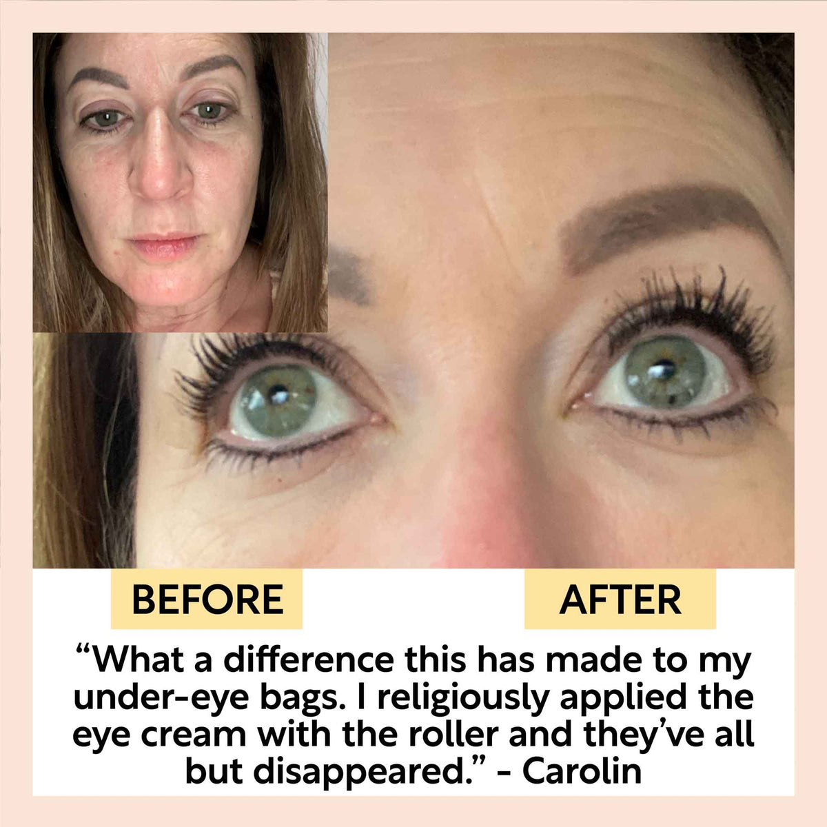 UpCircle The Caffeinated Duo + Eye Roller Deal with before/after eye results collage on Tampa Home & Garden Store