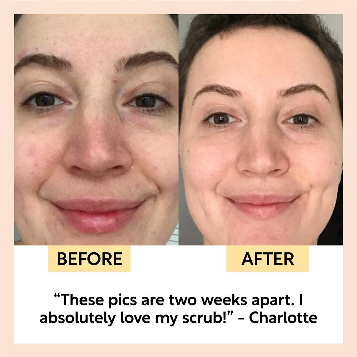 Travel-Size Skincare Bundle by UpCircle, two-panel before and after comparison on Tampa Home & Garden Store