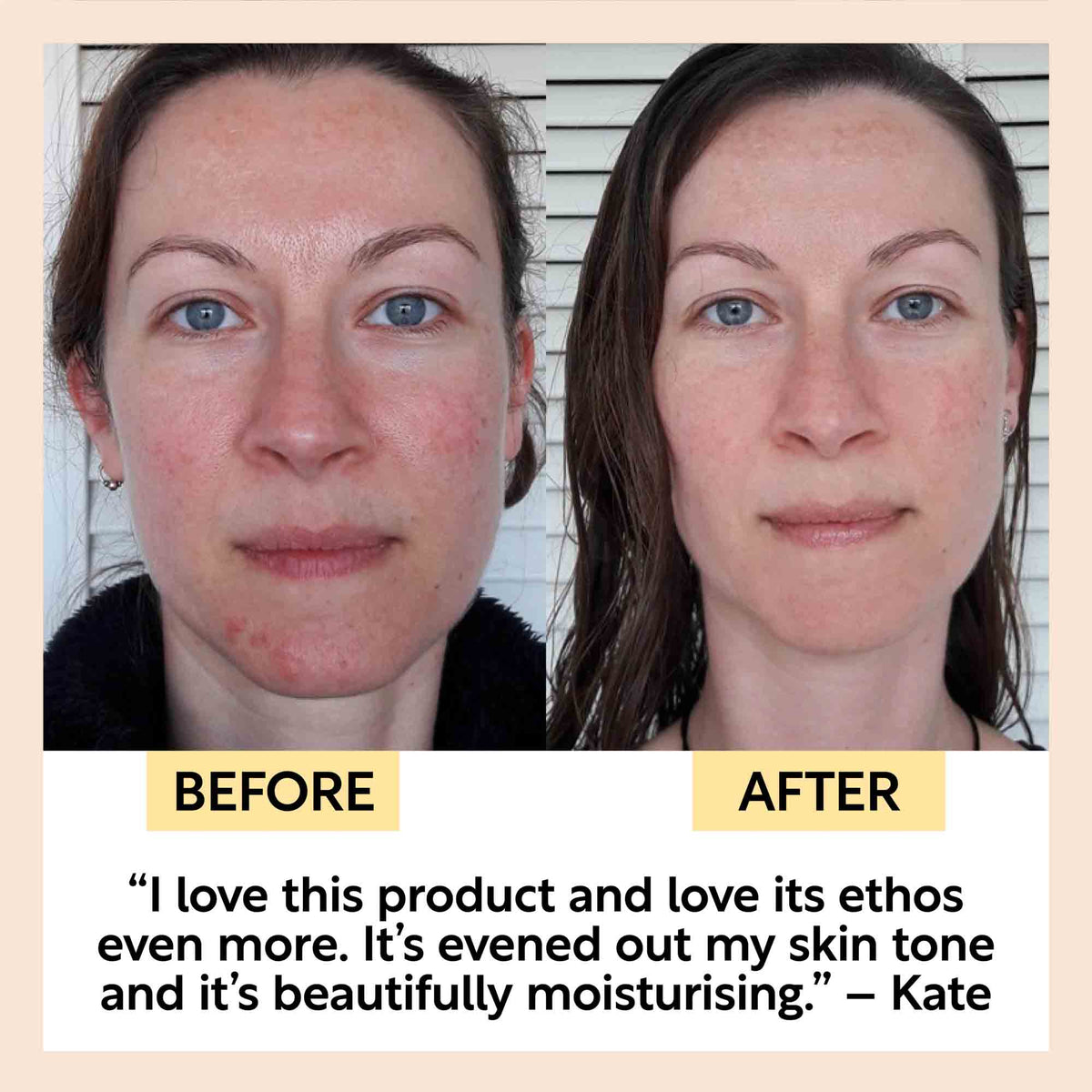 Anti-Aging Skincare Bundle by UpCircle body scrubs kit, two-panel before/after facial results on Tampa Home & Garden Store