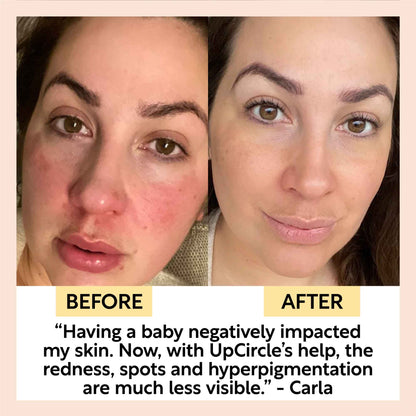 Day and Night Hydration Set by UpCircle, before and after collage showing clearer skin on Tampa Home & Garden Store