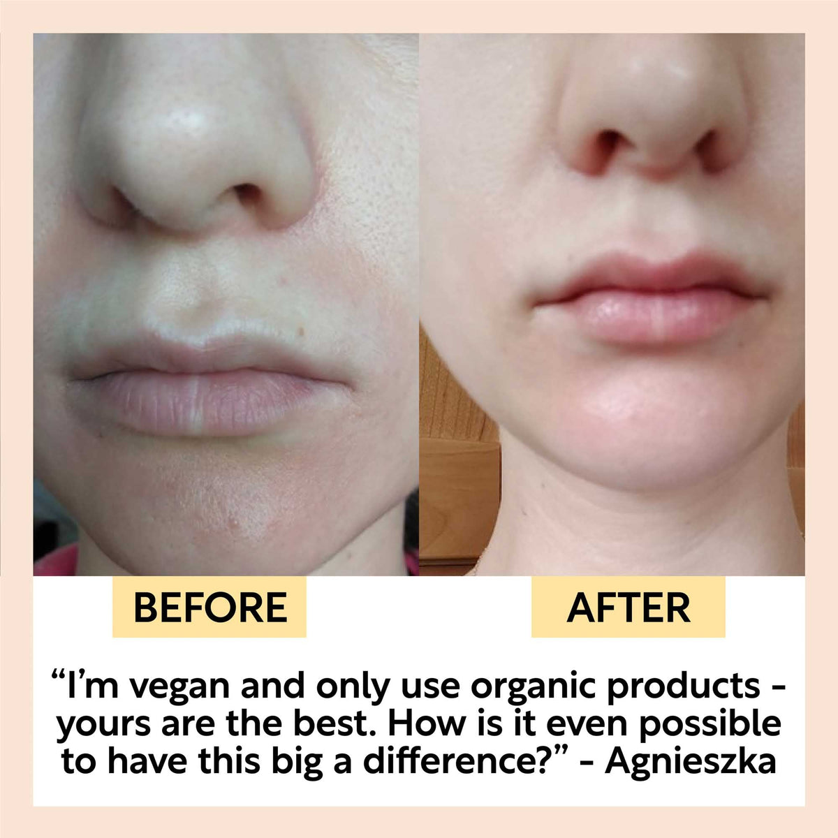 Hydration Skincare Set by UpCircle, facial moisturizers, before and after hydration on Tampa Home & Garden Store