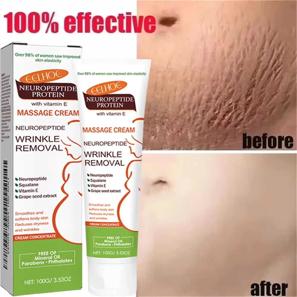 Silcy Skin Neuropeptide Protein Massage Cream Wrinkle Removal 100g tube and box on Tampa Home & Garden Store