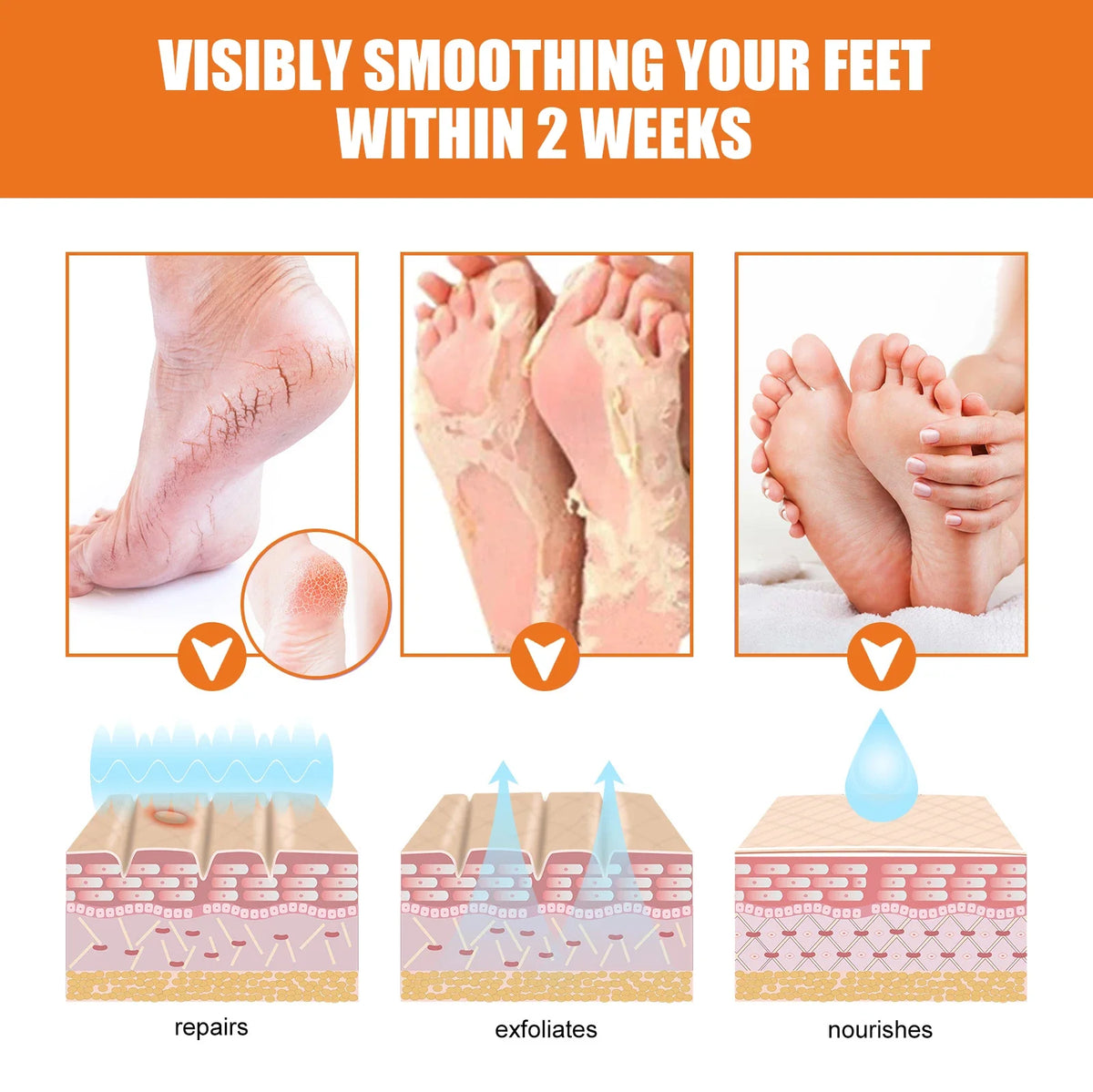 Jaysuing foot exfoliating spray removes dead skin to soften and moisturize dry feet on Tampa Home & Garden Store