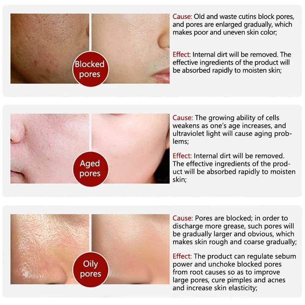Silcy Skin Texture Pore Refining Serum with retinol and niacinamide; blocked, aged, oily pores on Tampa Home & Garden Store