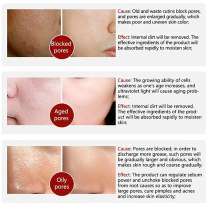 Silcy Skin Texture Pore Refining Serum with retinol and niacinamide; blocked, aged, oily pores on Tampa Home & Garden Store