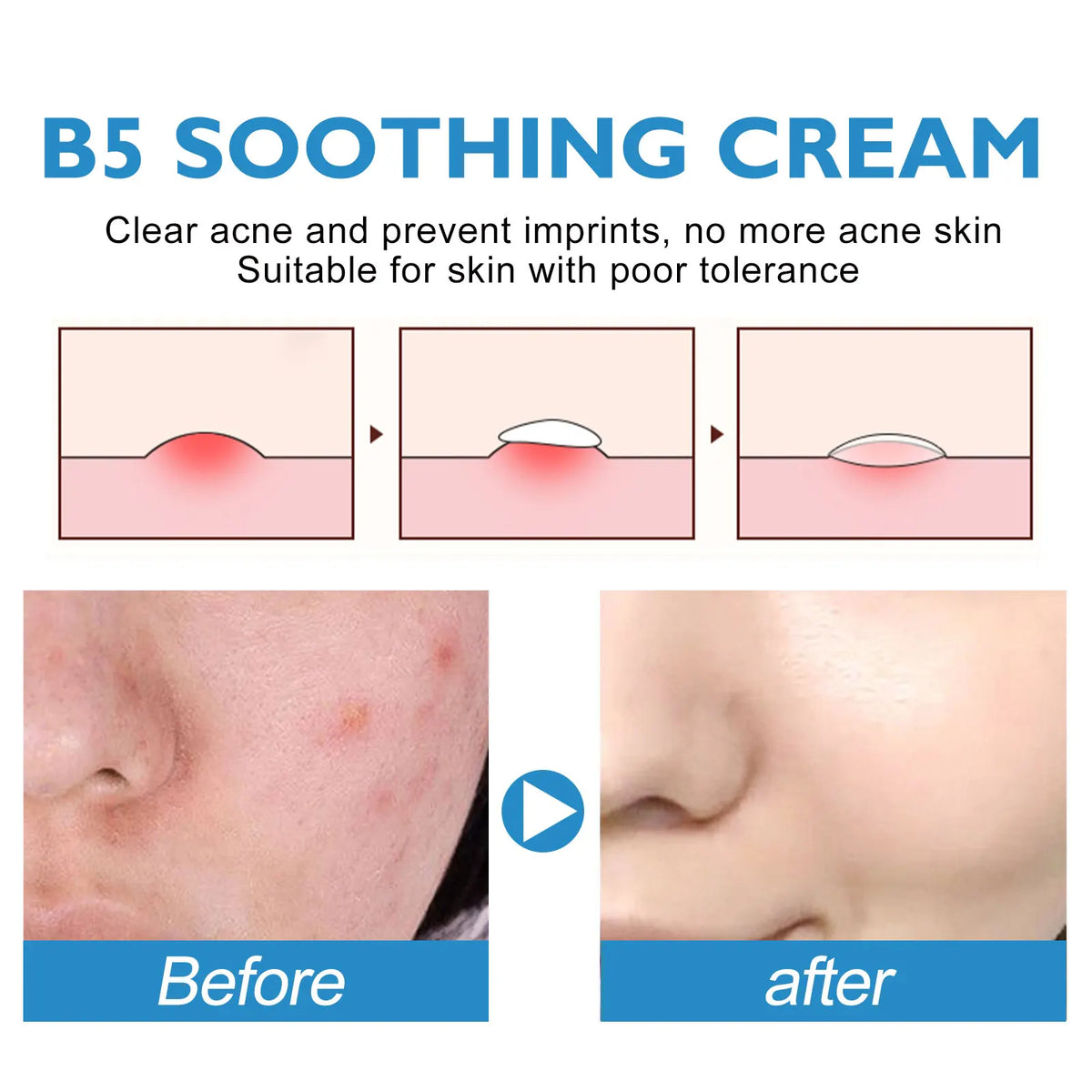 B5 Soothing Cream by Silcy Skin hydrating facial for dry red skin before/after results on Tampa Home & Garden Store