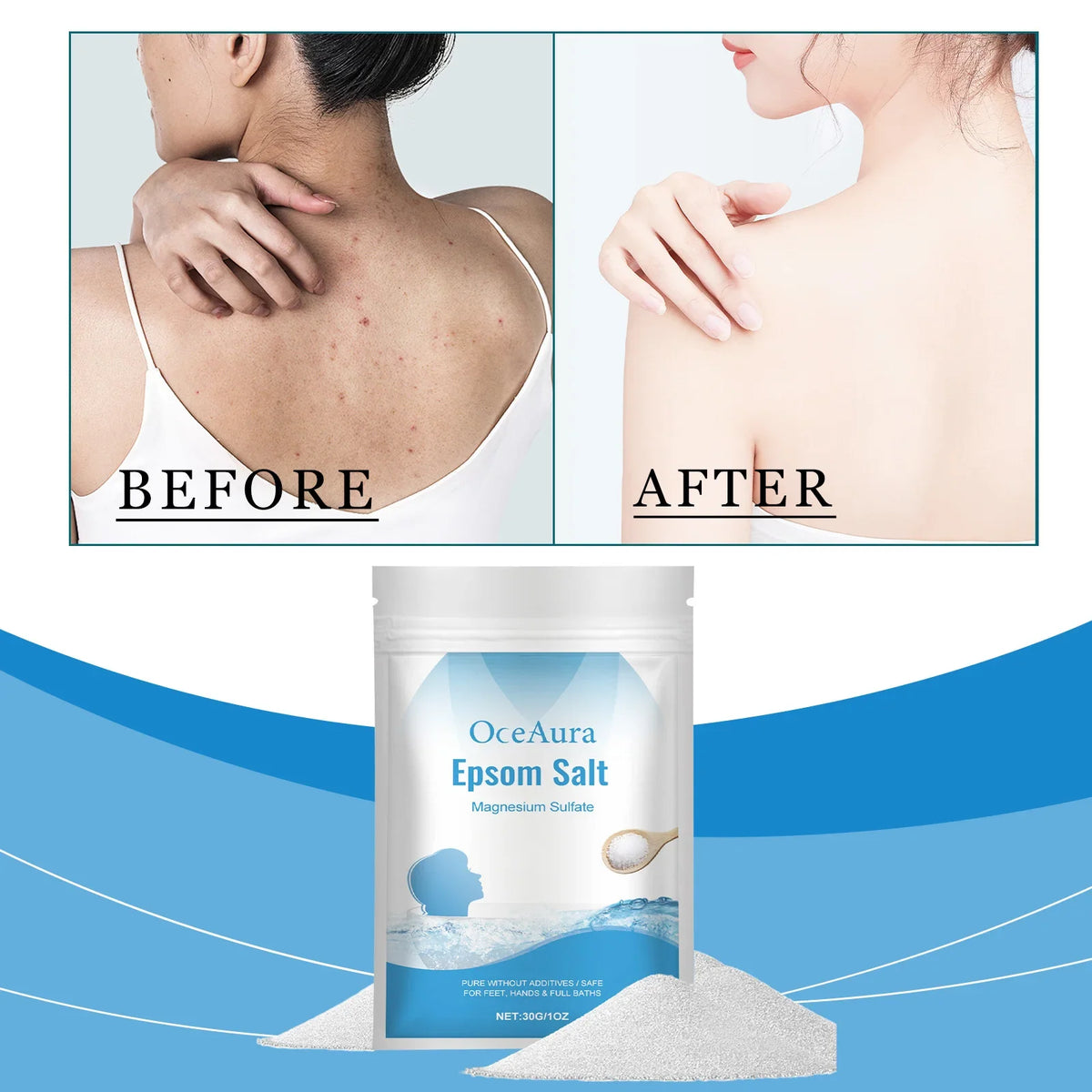 Epsom Salt Magnesium Sulfate bag Silcy Skin blue ocean packaging before after skin collage on Tampa Home & Garden Store