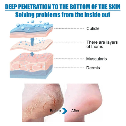 Silcy Skin Exfoliating Foot Mask socks dead skin removal with before after peeling image on Tampa Home & Garden Store