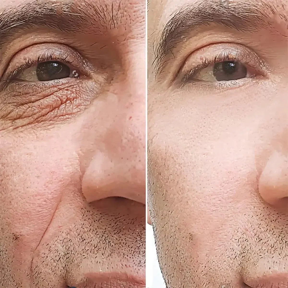 Silcy Skin Retinol anti-wrinkle cream for men before-after closeups show smoother skin on Tampa Home & Garden Store