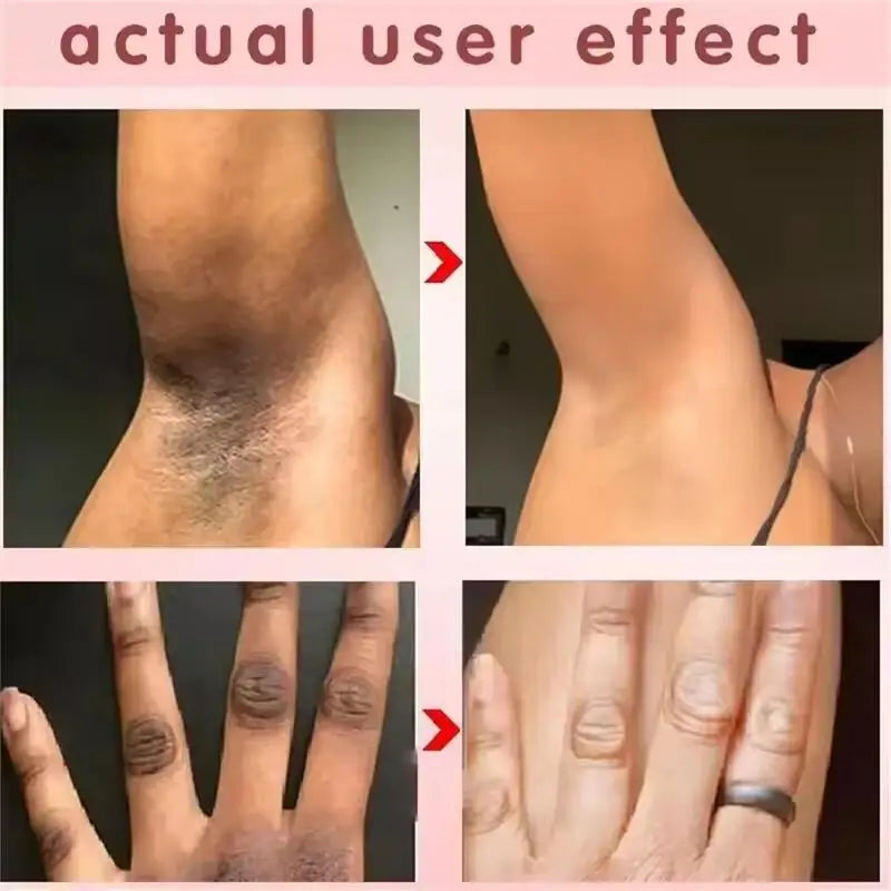 Silcy Skin whitening cream before/after collage for underarms and hands on Tampa Home & Garden Store
