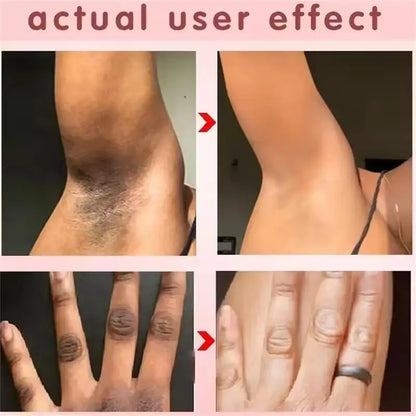 Silcy Skin whitening cream before/after collage for underarms and hands on Tampa Home & Garden Store