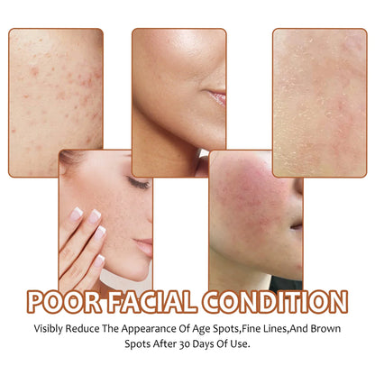 Silcy Skin Lemon Turmeric Kojic Acid Soap collage before/after showing pores and smoother tone on Tampa Home & Garden Store