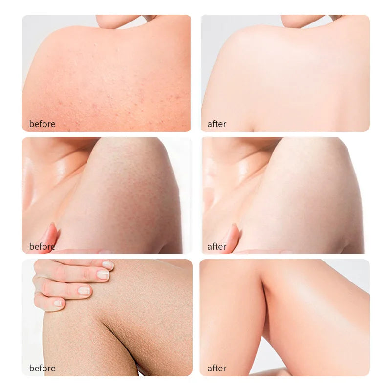 Silcy Skin castor oil before-after skin smoothing collage; back, arm, thigh (6 images) on Tampa Home & Garden Store