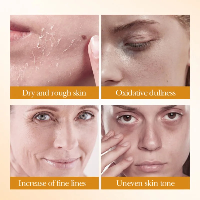 Silcy Skin 5pc BIOAOUA Rice Whitening skincare set for dry skin dullness uneven tone on Tampa Home & Garden Store