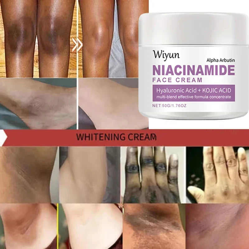 Body whitening cream for leg and underarm lightening with Silcy Skin Niacinamide cream jar on Tampa Home & Garden Store