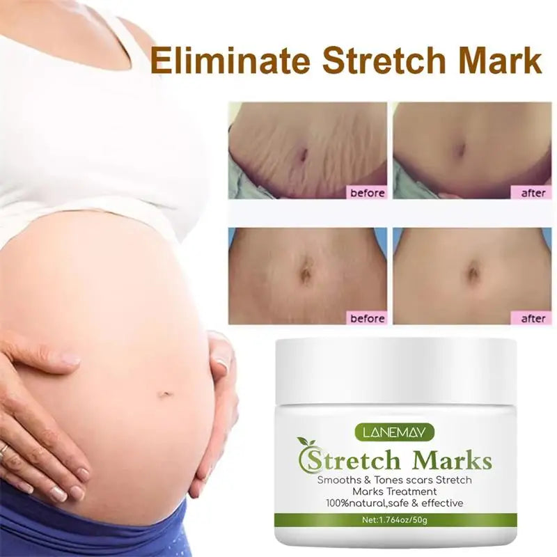 Stretch Marks cream for pregnancy by Silcy Skin on Tampa Home & Garden Store