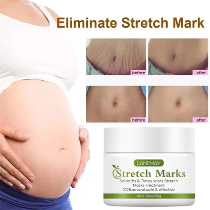 Stretch Marks cream for pregnancy by Silcy Skin on Tampa Home & Garden Store