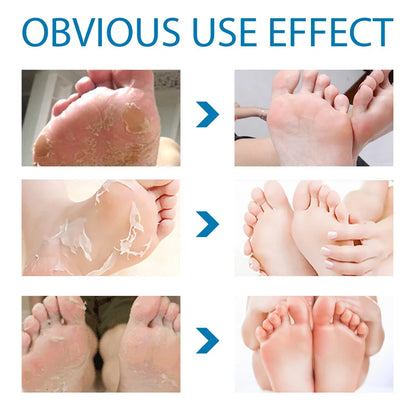 Silcy Skin Exfoliating Foot Mask 3 sets before after peeling dead skin to smooth feet on Tampa Home & Garden Store