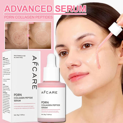 AFCARE PDRN collagen peptide serum bottle with pink dropper and box, 30g on Tampa Home & Garden Store