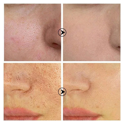 Skin Texture pore refining resurfacing serum by Silcy Skin; before after facial closeups show refined pores on Tampa Home & Garden Store