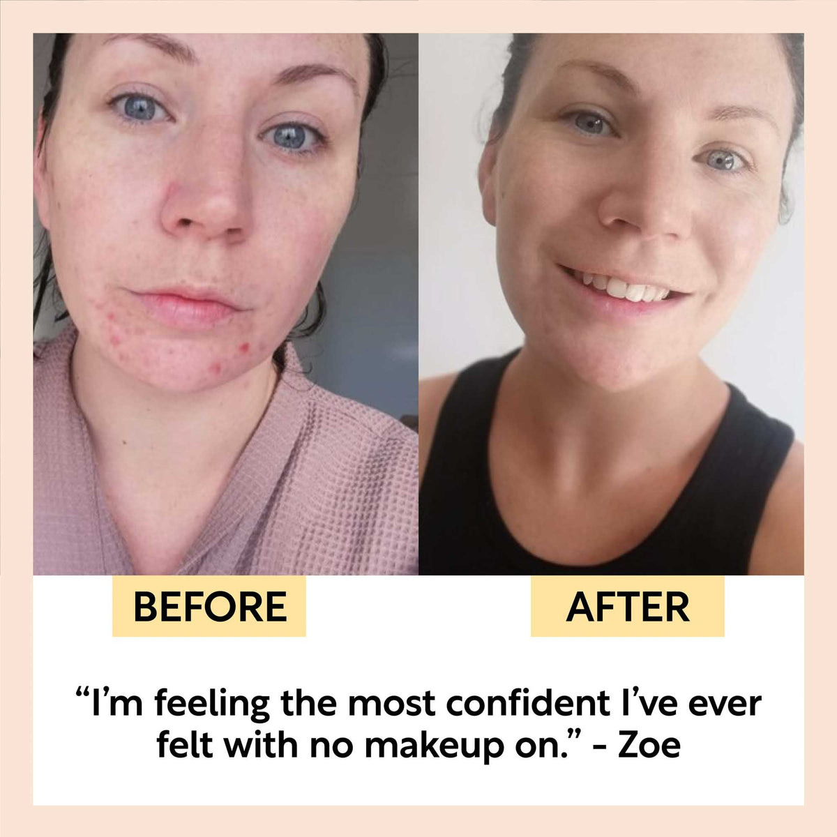 Travel-Size Skincare Bundle by UpCircle - 2-panel before/after skin transformation collage on Tampa Home & Garden Store