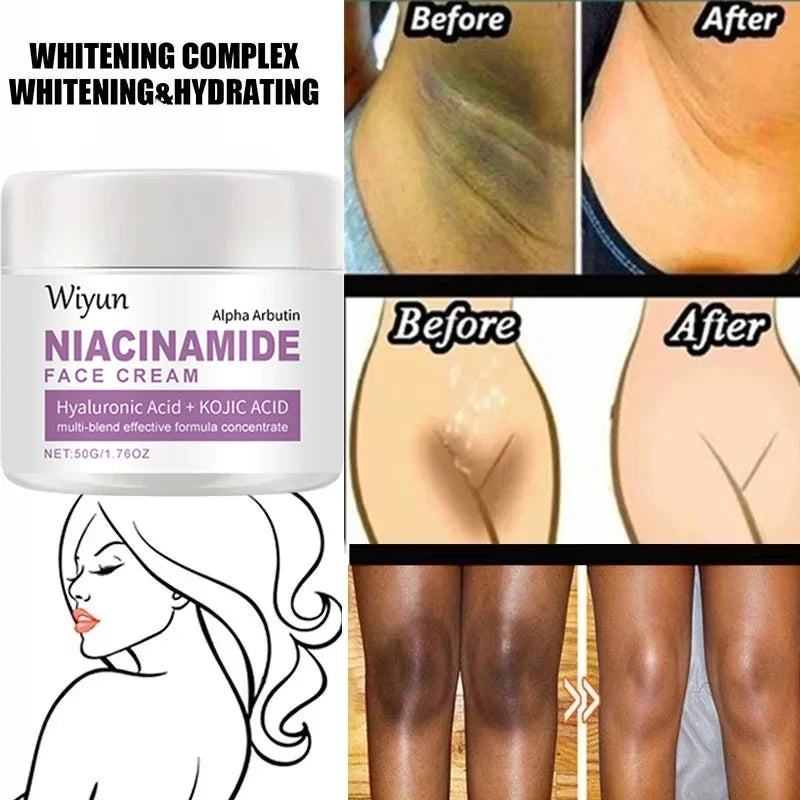 Silcy Skin Niacinamide Cream; whitening and hydrating collage of underarms on Tampa Home & Garden Store