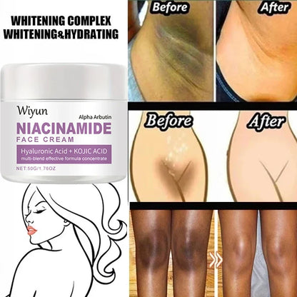Silcy Skin Niacinamide Cream; whitening and hydrating collage of underarms on Tampa Home & Garden Store