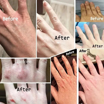 Silcy Skin Wrinkle Removal Hand Cream for dry cracked hands with moisturizing repair collage on Tampa Home & Garden Store