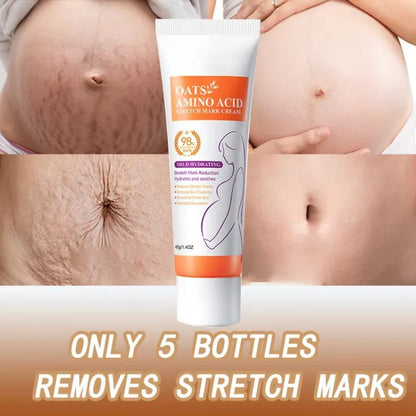 Oats Amino Acid Stretch Mark Cream tube beside maternity belly stretch marks on Tampa Home & Garden Store