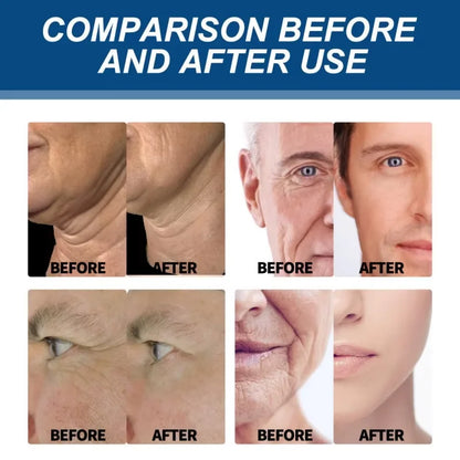 Silcy Skin Retinol Anti-wrinkle Cream for Men, Korean skincare moisturizer eight panels on Tampa Home & Garden Store
