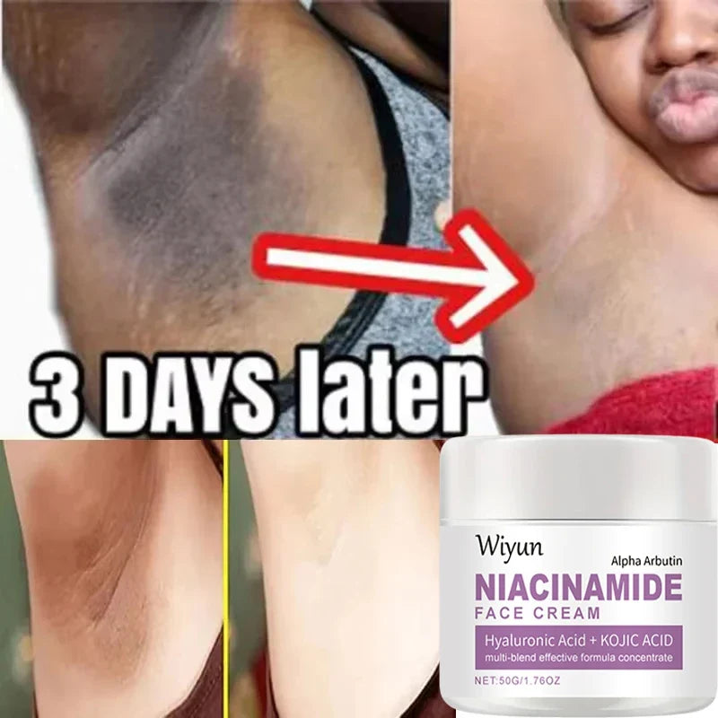 Silcy Skin body whitening cream underarm collage with Wiyun Niacinamide Face Cream jar on Tampa Home & Garden Store