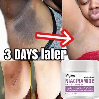 Silcy Skin body whitening cream underarm collage with Wiyun Niacinamide Face Cream jar on Tampa Home & Garden Store